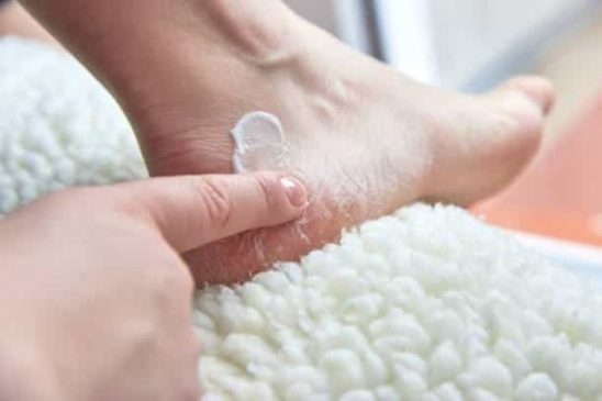 Foot fungus remedy