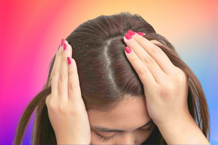 How Long Does It Take For Dandruff Shampoo To Work